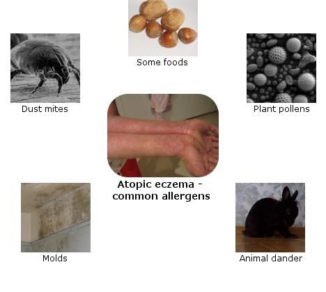 featured image - How to Get Rid of Allergens in Your Home