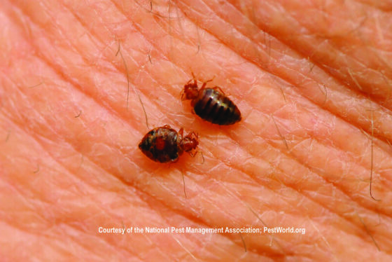 featured image - Signs and Symptoms of Bed Bugs