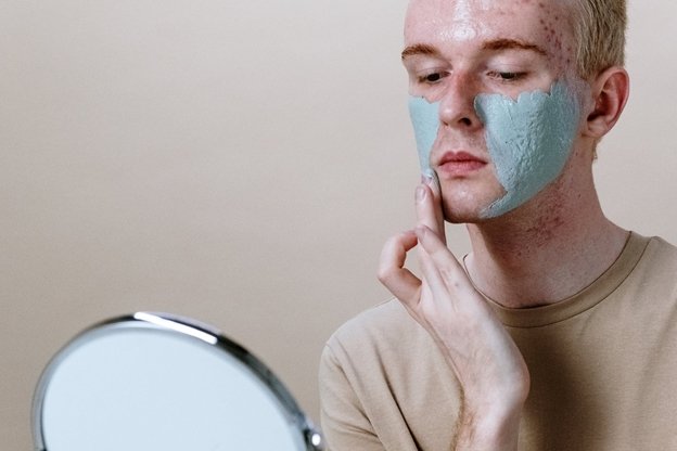 How to Reduce Acne Scarring: Treatments and Tips image - How to Reduce Acne Scarring: Treatments and Tips