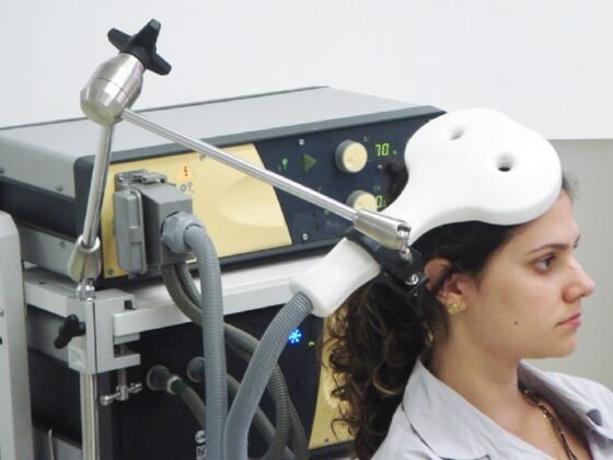 Featured image - The Advantages and Disadvantages of TMS Therapy for Anxiety